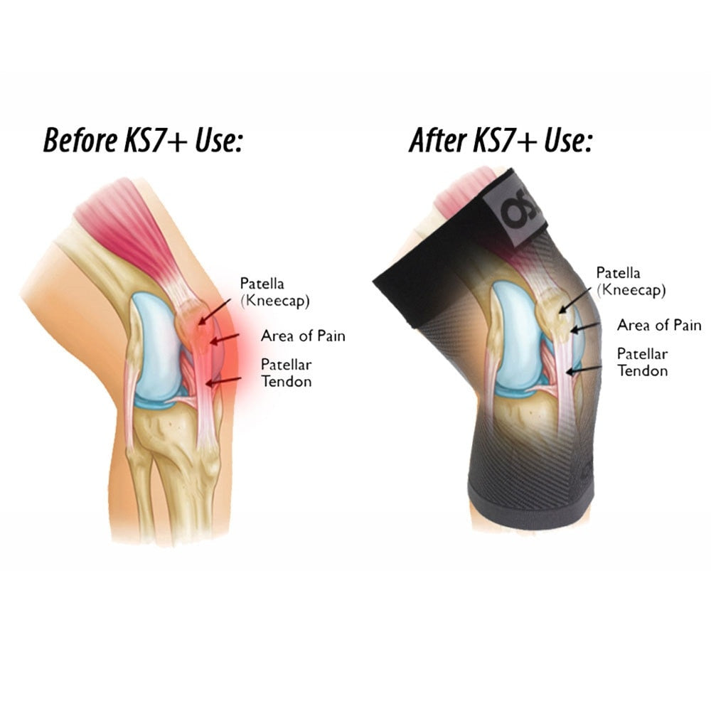 OS1st  KS7+ Adjustable Performance Knee Sleeve | Pickleball Sports